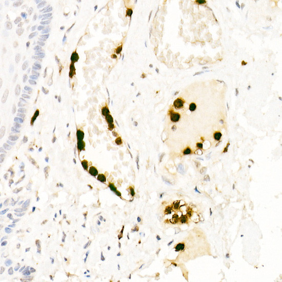 Neutrophil elastase Antibody in Immunohistochemistry (Paraffin) (IHC (P))