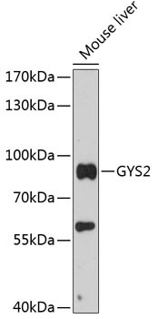 GYS2 Antibody in Western Blot (WB)