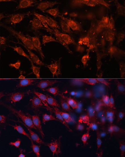 IGF2R Antibody in Immunocytochemistry (ICC/IF)