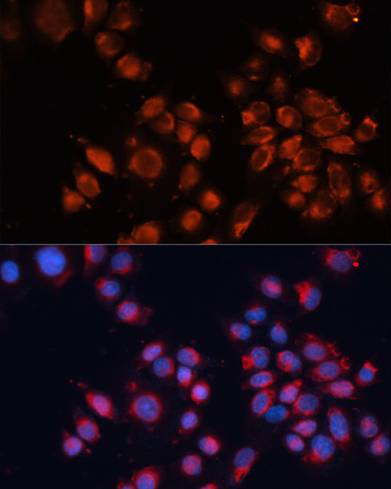 IGF2R Antibody in Immunocytochemistry (ICC/IF)