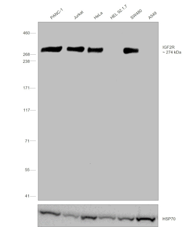 IGF2R Antibody