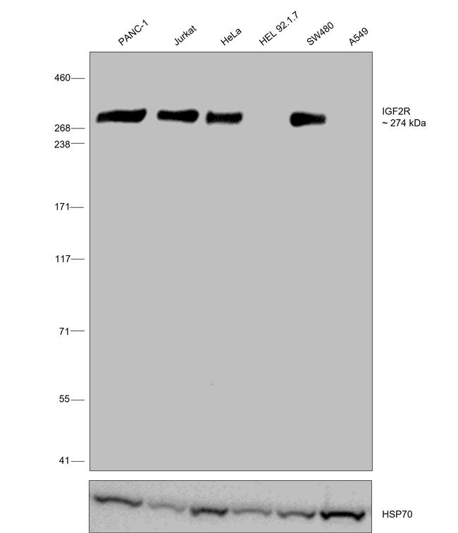 IGF2R Antibody in Western Blot (WB)