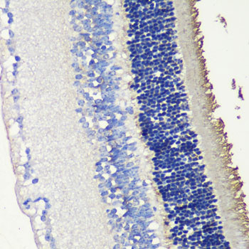 S-arrestin Antibody in Immunohistochemistry (Paraffin) (IHC (P))