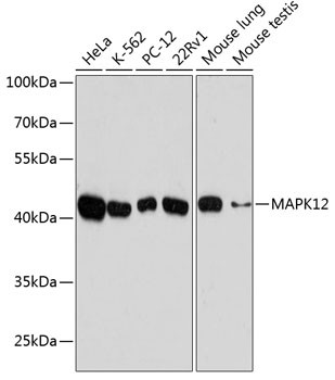 p38 MAPK gamma Antibody in Western Blot (WB)