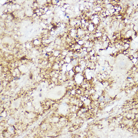 SREBP2 Antibody in Immunohistochemistry (Paraffin) (IHC (P))