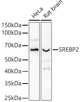 SREBP2 Antibody in Western Blot (WB)