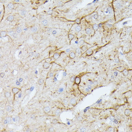 TBCA Antibody in Immunohistochemistry (Paraffin) (IHC (P))