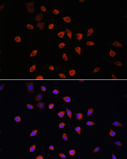 IFT88 Antibody in Immunocytochemistry (ICC/IF)