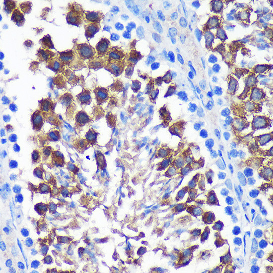 SENP1 Antibody in Immunohistochemistry (Paraffin) (IHC (P))