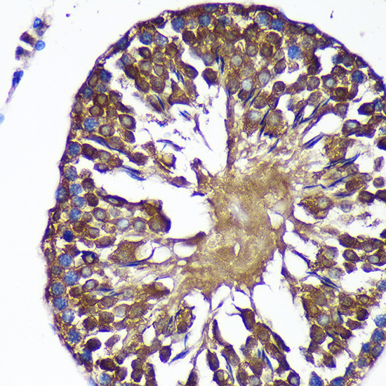 SENP1 Antibody in Immunohistochemistry (Paraffin) (IHC (P))