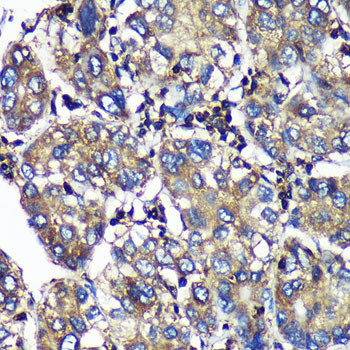 SENP1 Antibody in Immunohistochemistry (Paraffin) (IHC (P))