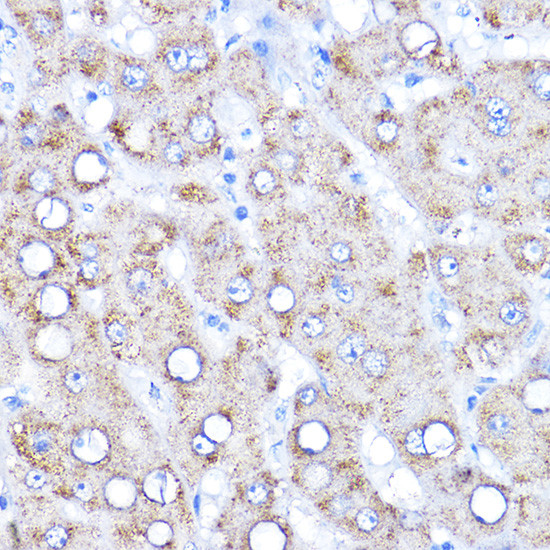 AADAT Antibody in Immunohistochemistry (Paraffin) (IHC (P))