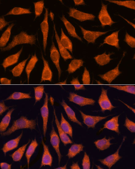 GOLPH3 Antibody in Immunocytochemistry (ICC/IF)