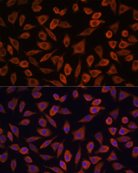 TSLP Antibody in Immunocytochemistry (ICC/IF)