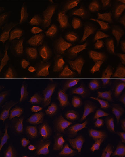 TSLP Antibody in Immunocytochemistry (ICC/IF)