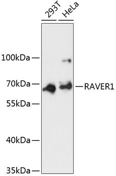 RAVER1 Antibody in Western Blot (WB)