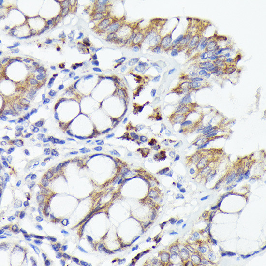 IL-1 alpha Antibody in Immunohistochemistry (Paraffin) (IHC (P))