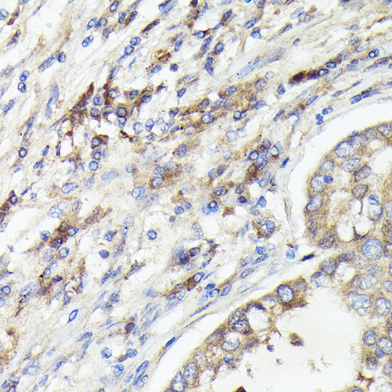 IL-1 alpha Antibody in Immunohistochemistry (Paraffin) (IHC (P))