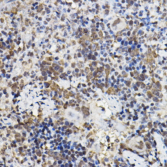 PER2 Antibody in Immunohistochemistry (Paraffin) (IHC (P))