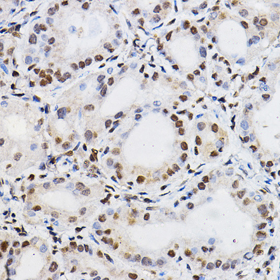 PER2 Antibody in Immunohistochemistry (Paraffin) (IHC (P))