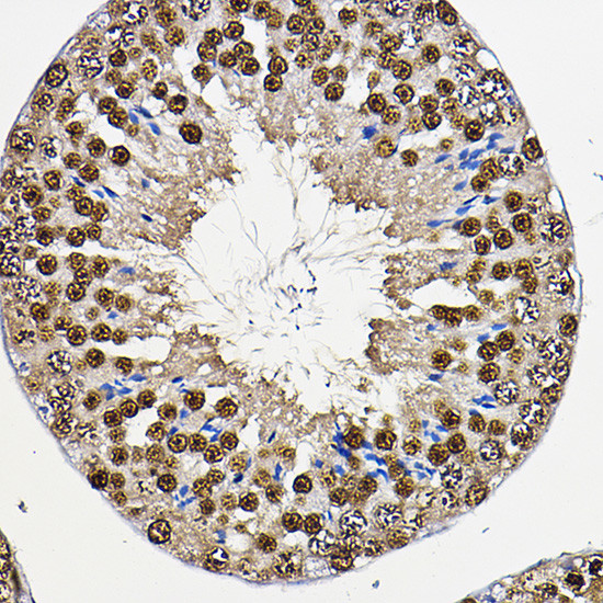 PER2 Antibody in Immunohistochemistry (Paraffin) (IHC (P))