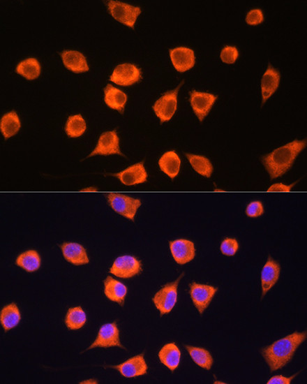 SCYL2 Antibody in Immunocytochemistry (ICC/IF)