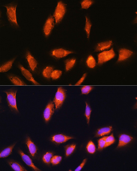 SCYL2 Antibody in Immunocytochemistry (ICC/IF)