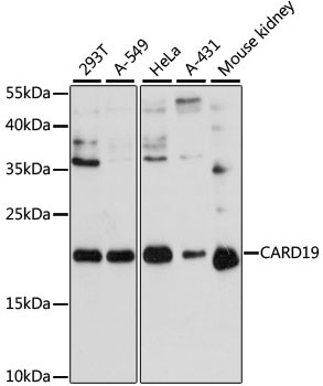 C9orf89 Antibody in Western Blot (WB)