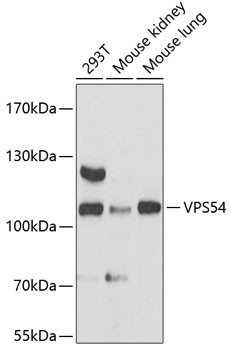 VPS54 Antibody in Western Blot (WB)