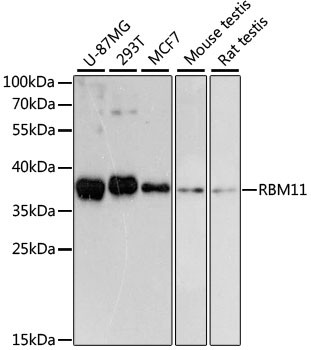 RBM11 Antibody in Western Blot (WB)