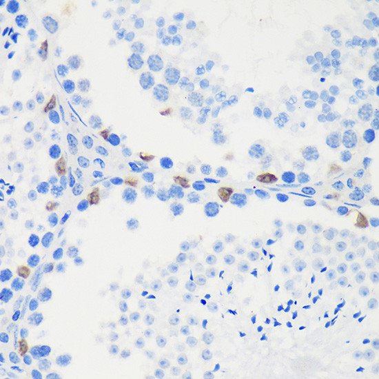 LARP2 Antibody in Immunohistochemistry (Paraffin) (IHC (P))