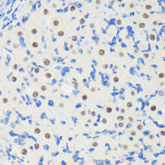 LARP2 Antibody in Immunohistochemistry (Paraffin) (IHC (P))