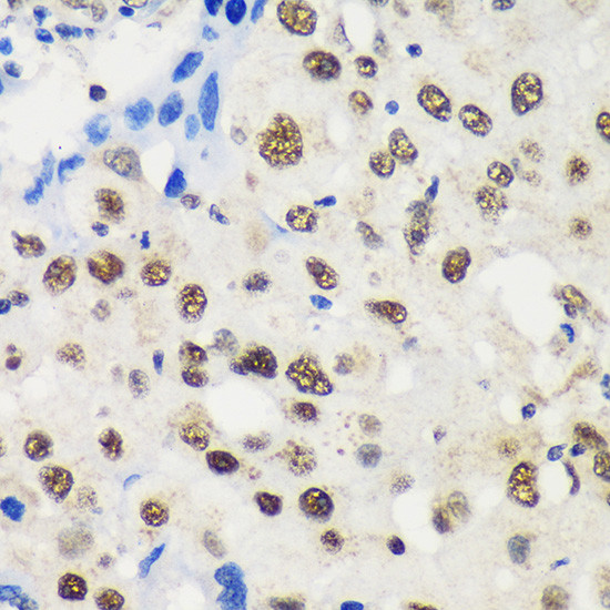 LARP2 Antibody in Immunohistochemistry (Paraffin) (IHC (P))