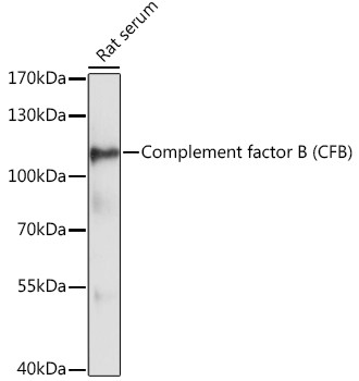 Complement Factor B Antibody in Western Blot (WB)