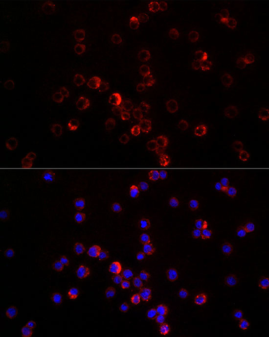 CXCL12 Antibody in Immunocytochemistry (ICC/IF)