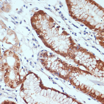 CXCL12 Antibody in Immunohistochemistry (Paraffin) (IHC (P))