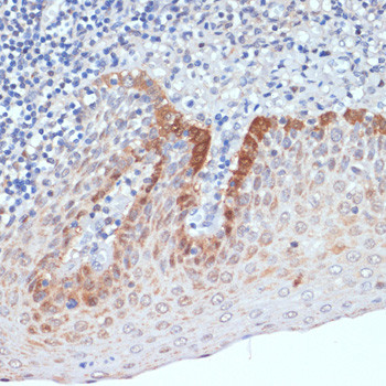 CXCL12 Antibody in Immunohistochemistry (Paraffin) (IHC (P))