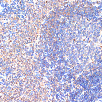 CXCL12 Antibody in Immunohistochemistry (Paraffin) (IHC (P))