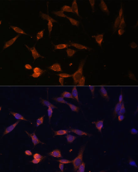 UMPS Antibody in Immunocytochemistry (ICC/IF)