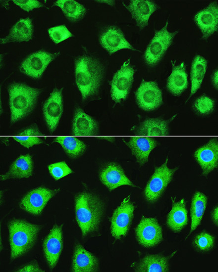 YTHDF1 Antibody in Immunocytochemistry (ICC/IF)