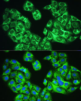 YTHDF1 Antibody in Immunocytochemistry (ICC/IF)