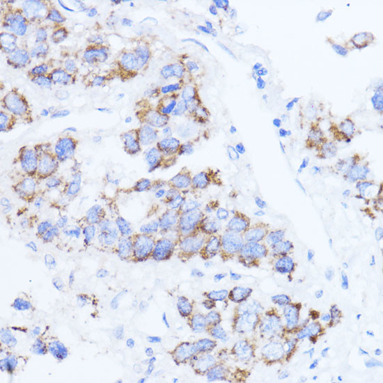 ACAT1 Antibody in Immunohistochemistry (Paraffin) (IHC (P))