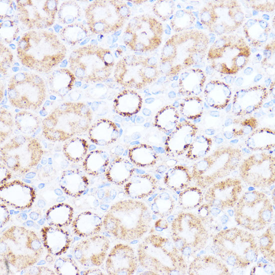 ACAT1 Antibody in Immunohistochemistry (Paraffin) (IHC (P))