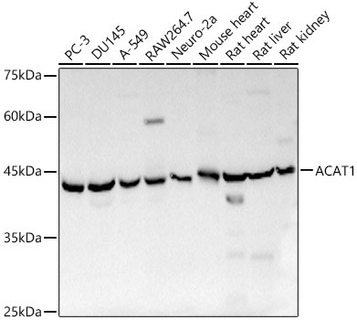 ACAT1 Antibody in Western Blot (WB)