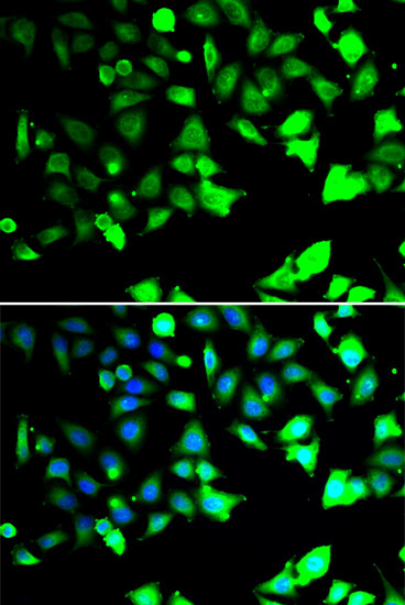 XIAP Antibody in Immunocytochemistry (ICC/IF)