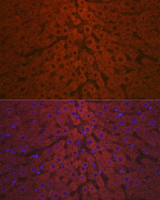 Complement C3 Antibody in Immunohistochemistry (Paraffin) (IHC (P))