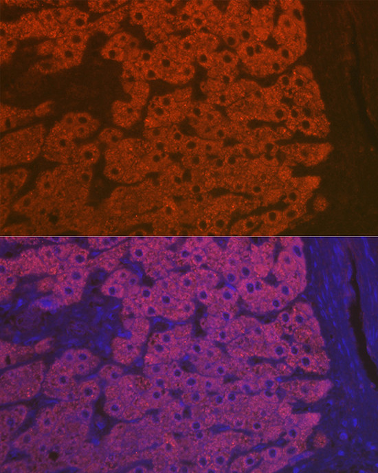 Complement C3 Antibody in Immunohistochemistry (Paraffin) (IHC (P))