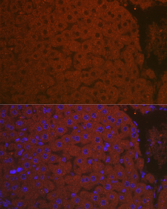 Complement C3 Antibody in Immunohistochemistry (Paraffin) (IHC (P))