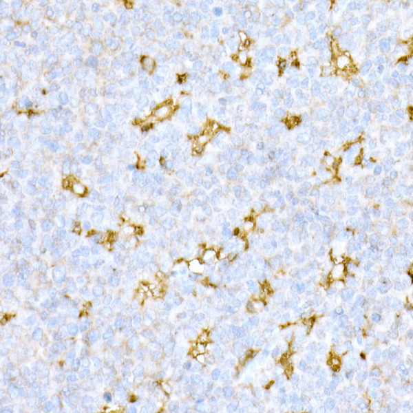 Cathepsin D Antibody in Immunohistochemistry (Paraffin) (IHC (P))