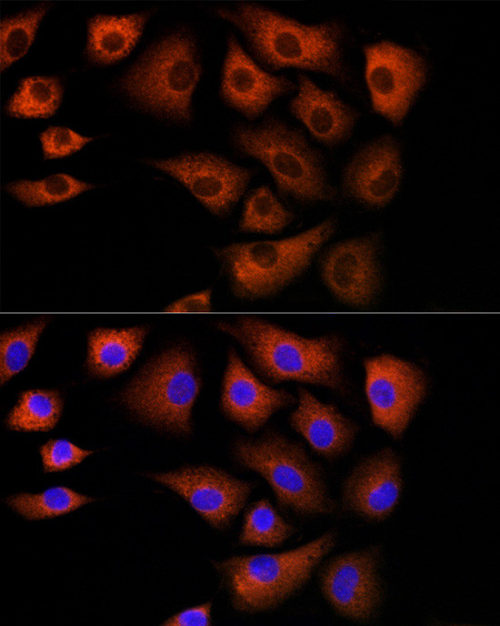 DBI Antibody in Immunocytochemistry (ICC/IF)